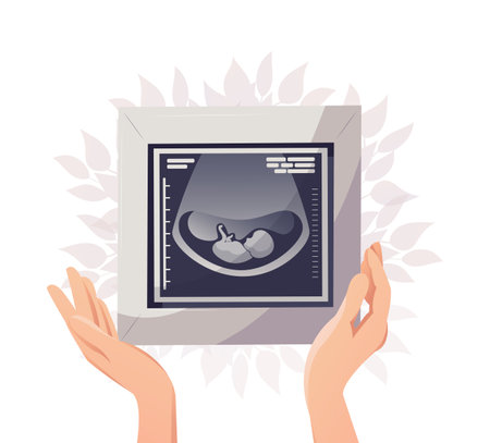 Ultrasonography picture, fetus ultrasound, vectorのイラスト素材