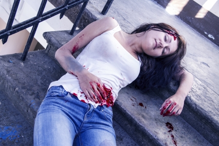 Girl injured on the stairsの写真素材