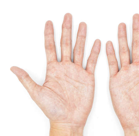 Sweaty palms of Asian young man. Isolated on white background.の写真素材
