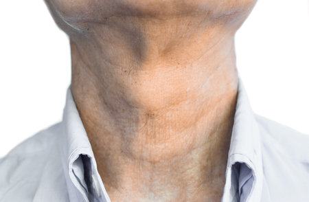Aging skin folds or skin creases or wrinkles at neck of Southeast Asian, Chinese old man. Isolated on white. Front view.の写真素材