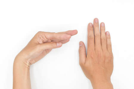 Alcoholic hand muscle spasm vs normal hand in Asian young man. Unilateral hand deformity. Abnormal fingers flexion. Isolated on white background.の写真素材