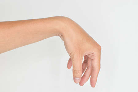 Radial nerve injury or wrist drop of Asian young man.の写真素材