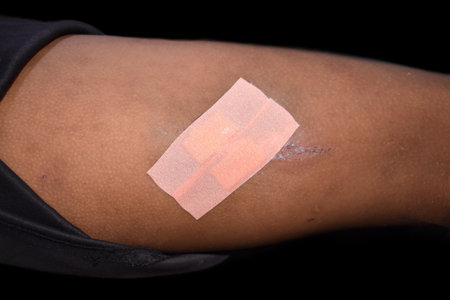 Universal plasters for traumatic wound in thigh of Asian child. Wound care.の写真素材