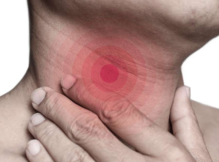 Redness at neck of Asian, Myanmar man. Concept of sore throat, pharyngitis, laryngitis or dysphagia.