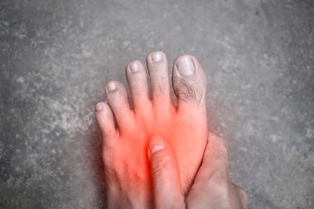 Painful foot of Asian young man with diabetes. Sensory neuropathy problems. Foot nerves problems.