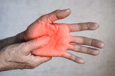 Painful palmar aspect of Asian old man. Concept of compartment syndrome, cellulitis and hand muscles pain.の写真素材