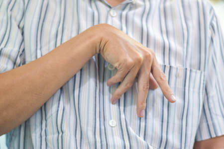 Ulnar claw hand of Asian elder man. also known as spinster claw. develops due to ulnar nerve damage causing weakness of the lumbricals.の写真素材