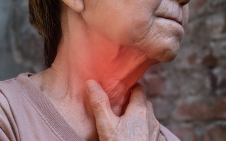 Redness at neck of Asian, Myanmar woman. Concept of sore throat, pharyngitis, laryngitis, thyroiditis, or dysphagia.の写真素材