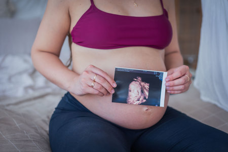 Pregnant woman holding ultrasound scan of her belly at home.の写真素材