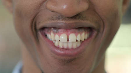 Mouth of Smiling African Man, Lips