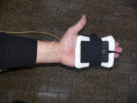 physiotherapy electrical impulse shock treatment of handの写真素材