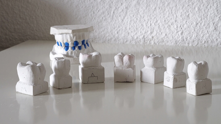 Dentist put artificial teeth on table desk, dental prosthetic dental jawの写真素材
