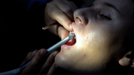 Little girl at the dentist examining a tooth with a dental mirrorの写真素材