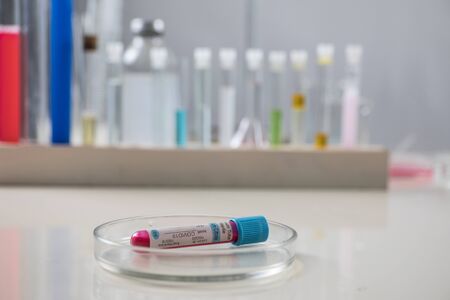 Positive blood test result for the new rapidly spreading Coronavirus. Close up. Selective focusの写真素材