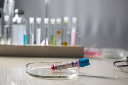 Positive blood test result for the new rapidly spreading Coronavirus. Close up. Selective focus