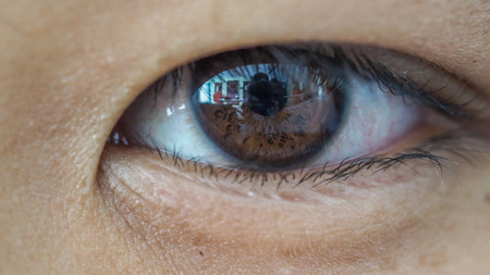 Eye