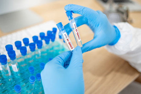 Medical scientist hand with blue sterile rubber gloves holding COVID-19 test tube in hospital...
