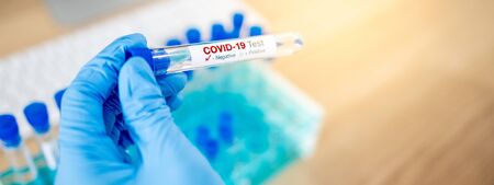 Medical scientist hand with blue sterile rubber gloves holding COVID-19 test tube in hospital laboratory. Male doctor or physician getting result of Coronavirus case. 2019-nCoV lab test conceptの写真素材