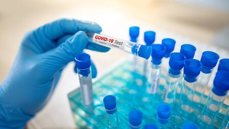 Medical scientist hand with blue sterile rubber gloves holding COVID-19 test tube in hospital laboratory. Male doctor or physician getting result of Coronavirus case. 2019-nCoV lab test conceptの写真素材