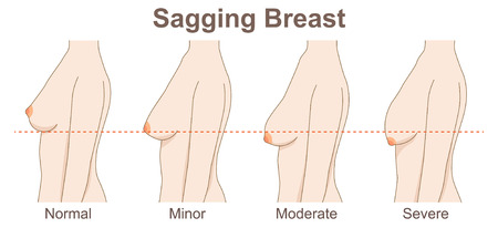 sagging breastのイラスト素材