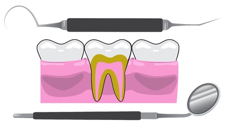 Dentist Toolsのイラスト素材