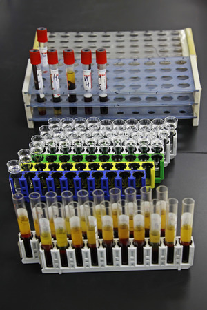 Laboratory tests glass tube, closeup of photoのeditorial素材