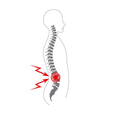Human spine pain vector illustration. Medical, educational and science banner.のイラスト素材