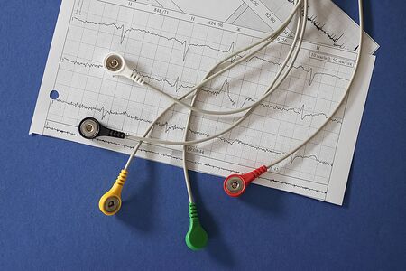 Holter monitoring device and cardiogram on blue  background. Soft focus.の写真素材