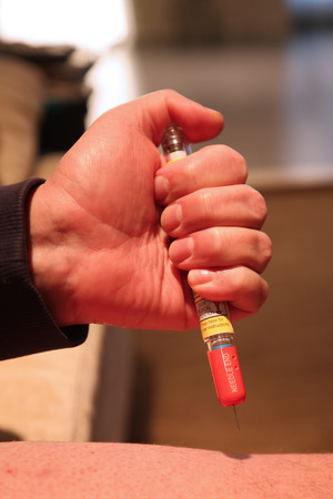 Injecting emergency medicine. Epinephrine Auto injector is a medical device for injecting doses of epinephrine or adrenaline through a needle into a patient suffering an allergyの写真素材