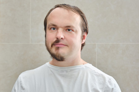 Before shaving and after. Collage portrait man with a half beard. Face man 35-40 years. Concept of...