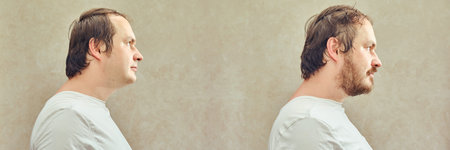 Portrait of a man 35-40 years old with a beard and without a beard, face in profile. Adult man before and after shaveの写真素材