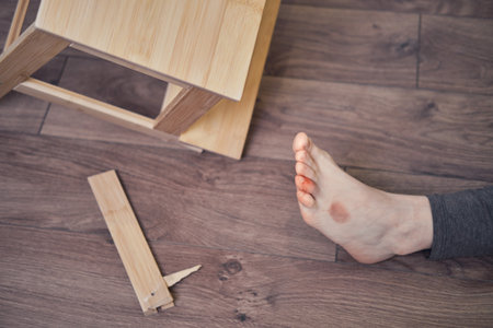 Woman injured foot on leg after falling from wooden stepladder. The problem with labor protection at diy work at homeの写真素材
