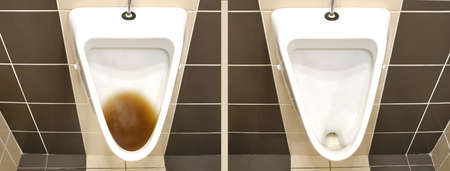 Blockage in the toilet urinal before and after fixing the problem. Disinfection and hygiene in toilets of public buildingsの写真素材