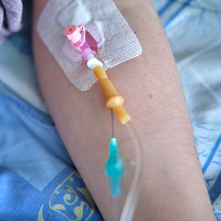 Hand with dropper needle and epidural anesthesia injection. Pregnant woman with an IV on the bed