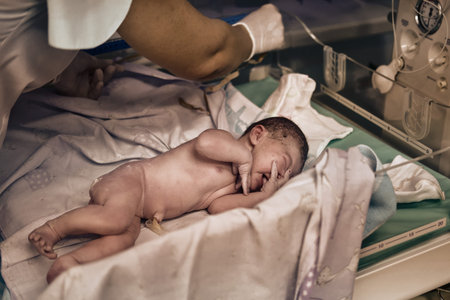A newborn baby is examined by a doctor after childbirth. Checking the baby after birth on the Apgar...