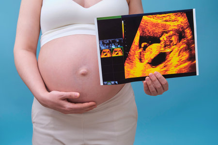 A pregnant woman holds an ultrasound with an unborn child, a studio photo on a blue background