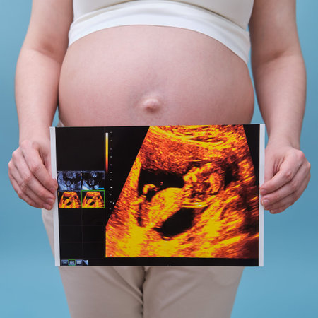 Pregnant woman with ultrasound results in her hands, studio shot