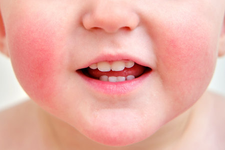 Portrait of a child with allergies on the cheeks and chin. Toddler baby boy with allergies on red face skin, white backgroundの写真素材