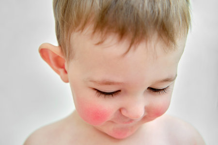 Portrait of a child with allergies on the cheeks and chin. Toddler baby boy with allergies on red face skin, white backgroundの写真素材