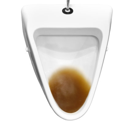 Dirty clogged urinal with water in the toilet of a restaurant, isolated on a white background. Disinfection and hygiene in toilets of public buildingsの写真素材