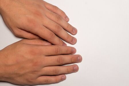 Man's nails in a bad condition. Biting fingernailsの写真素材