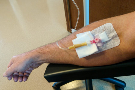 male hand with attached catheter for intravenous fluid therapy