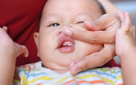 Close-up mother hands open baby mouth to examine first teeth. Infant primary tooth.の写真素材