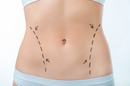 Ready for operation. Close up of stomach of nice young slim woman standing isolated on white backgroundの写真素材