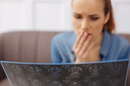 Astonished young patient looing desperateの写真素材