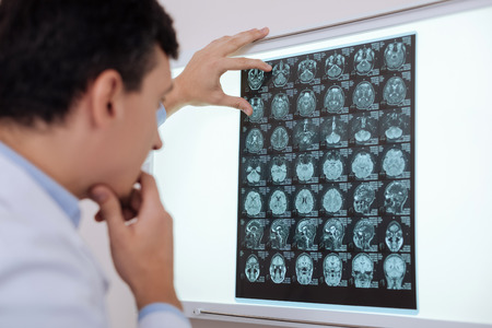 Serious thoughtful radiologist looking for a brain pathologyの写真素材