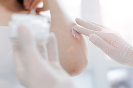 Proficient medical specialist putting cream on patient skin at workの写真素材