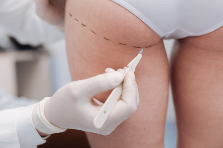 Prominent plastic surgery expert showing how he workingの写真素材