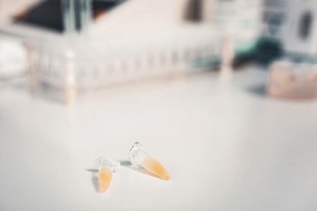 Medical service. Selective focus of two samples with analysis being left on white laboratory tableの写真素材