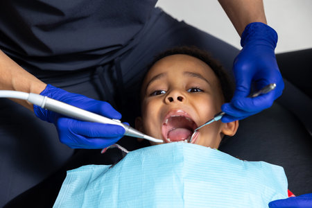 Dark-skinned boy having session in dentistryの写真素材